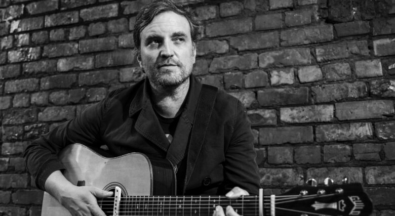 Singer James Walsh playing a guitar